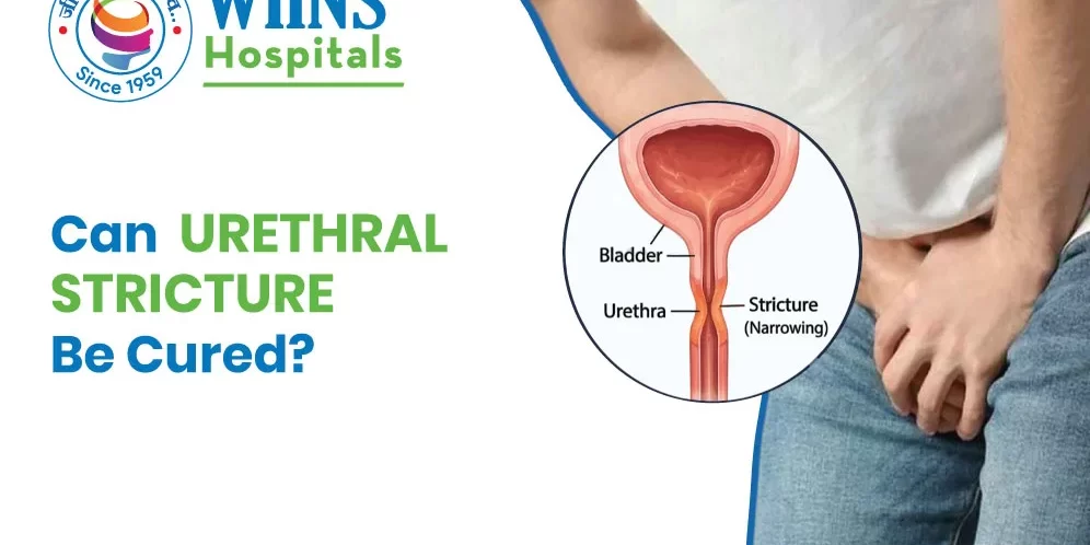 Can Urethral Stricture Be Cured? Can Urethral Stricture Be Cured?