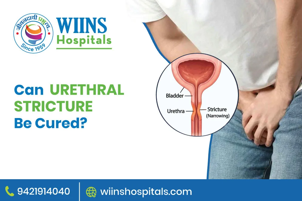 Can Urethral Stricture Be Cured?