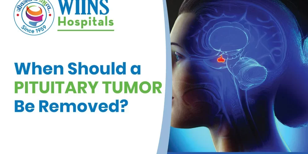When Should a Pituitary Tumor Be Removed?