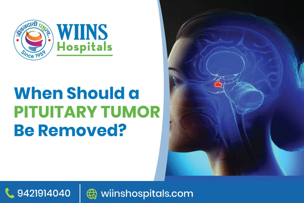 When Should a Pituitary Tumor Be Removed?