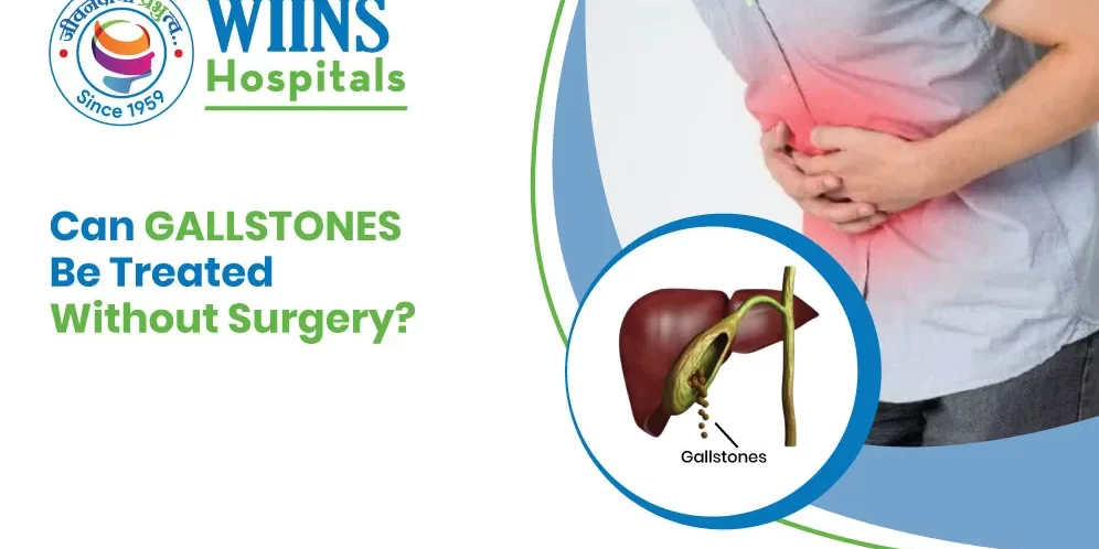 Can Gallstones Be Treated Without Surgery?